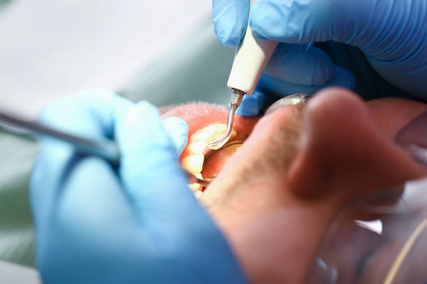 Best Pediatric Emergency Dentist in Shenorock, NY