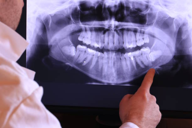 Best Emergency Dental Extractions in Shenorock, NY