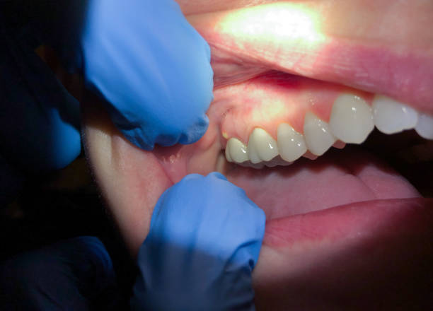 Best Orthodontic Emergency Dentist in Shenorock, NY