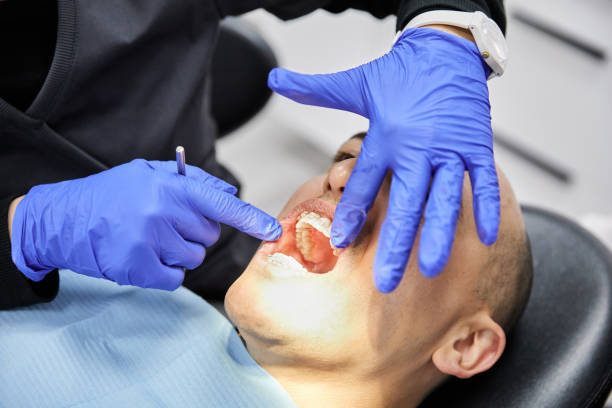 Best Broken or Cracked Tooth Emergency Dentist in Shenorock, NY